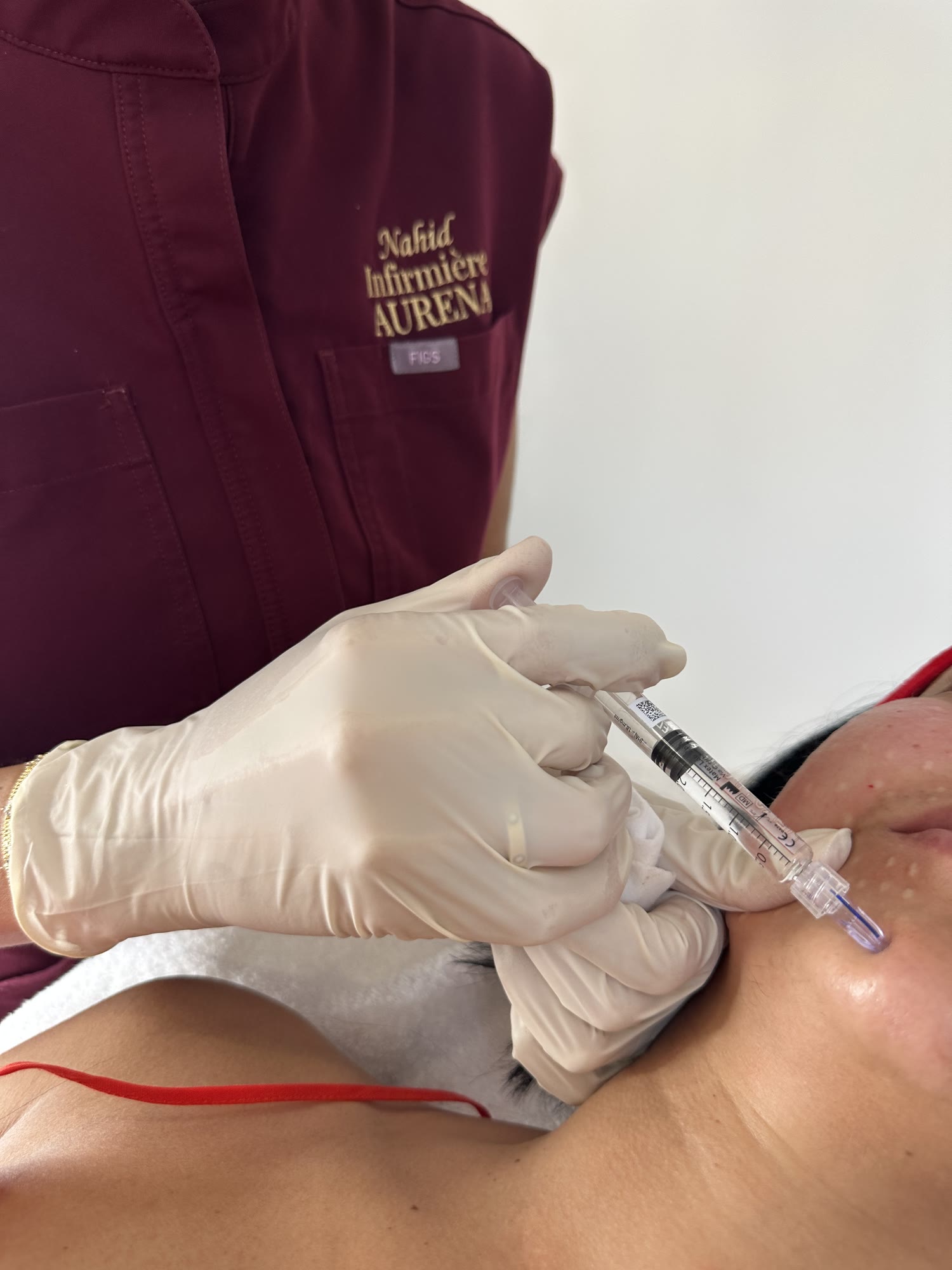 Injection réalisée sur le bas du visage à la clinique AURENA